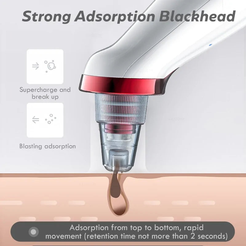 Blackhead Remover & Deep Nose Cleaner